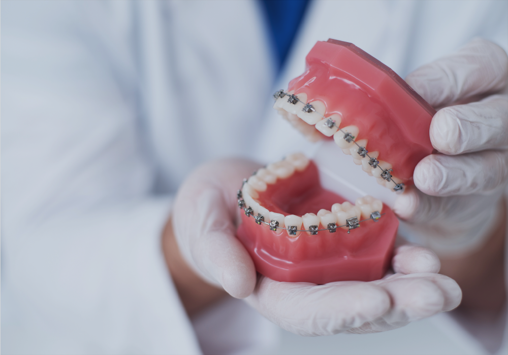 Case Study Ocean Orthodontics Goldbeck Recruiting